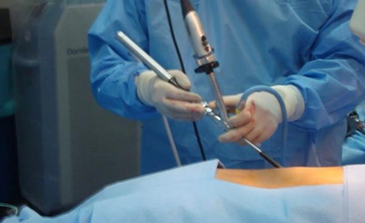 Hospiten referente en el tratamiento de los c�lculos en las v�as urinarias