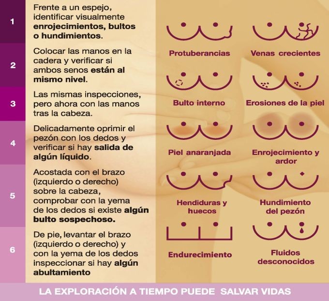 D�a Mundial contra el c�ncer de mama, 19 de octubre