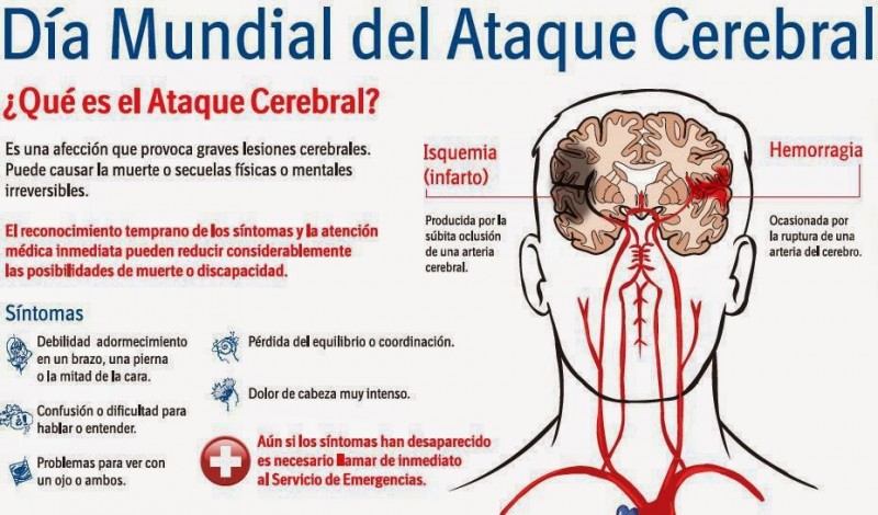 Canarias registra durante 2017 un total de 2.301 ingresos por ictus
