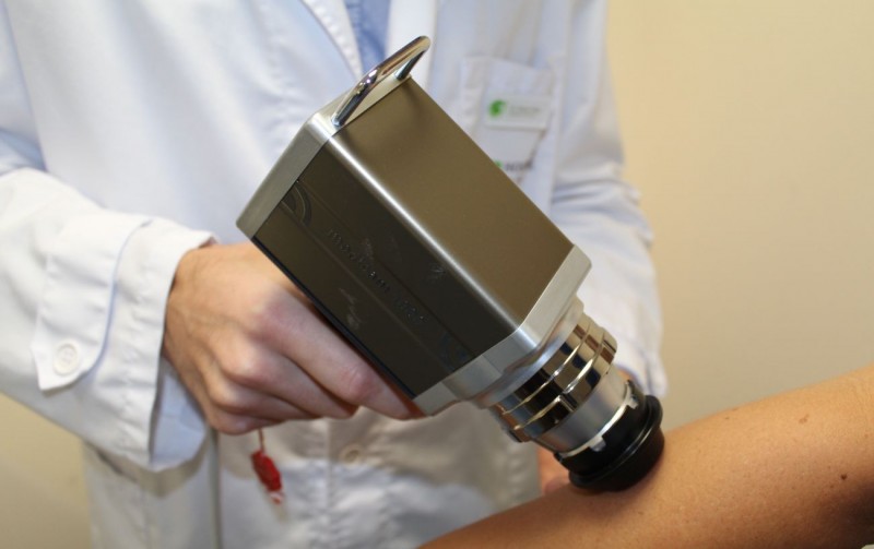 La tecnolog�a que salva vidas en el c�ncer de piel