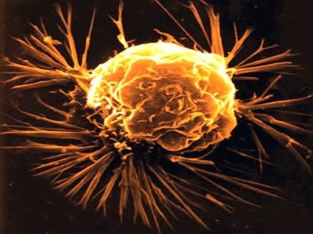 El Cancer uno de los grandes verdugos de esta sociedad 