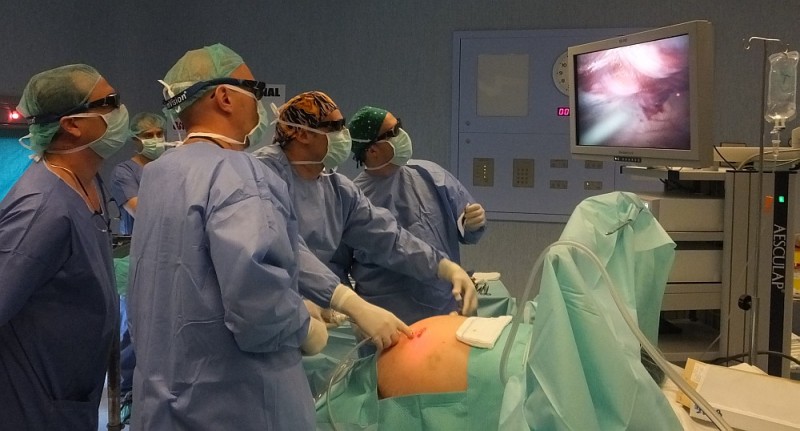 Hospitales San Roque Maspalomas se coloca a la vanguardia en intervenciones por laparoscopia en 3D
