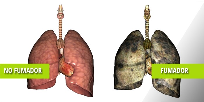 Las Farmacias ofrecer�n informaci�n sobre la prevenci�n de la EPOC 